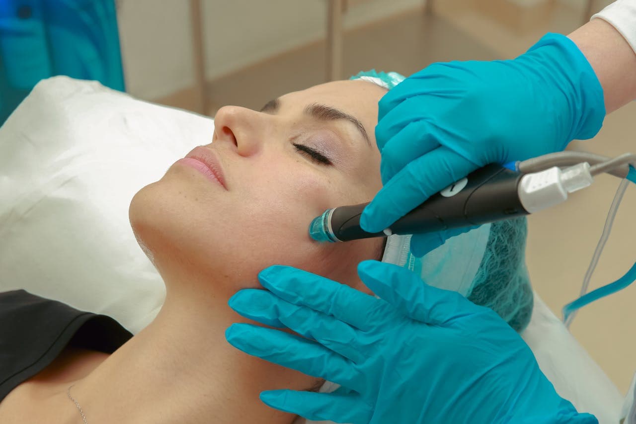 Microneedling zu Hause vs. Studio: Wann ist welches sinnvoll?